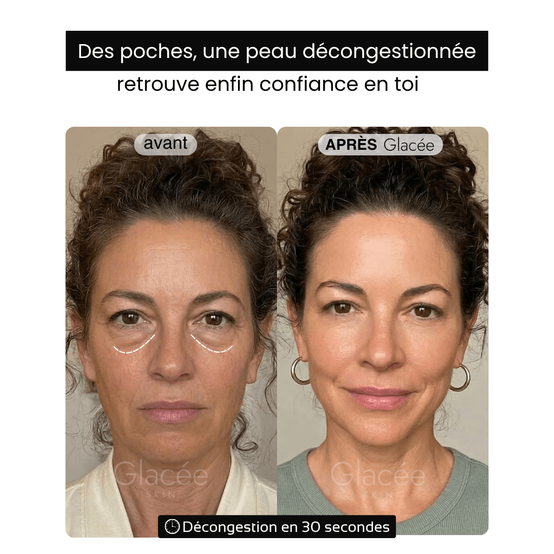 Glacée - Stick de Décongestion